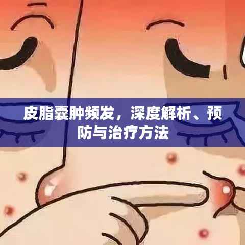皮脂囊肿频发,深度解析、预防与治疗方法